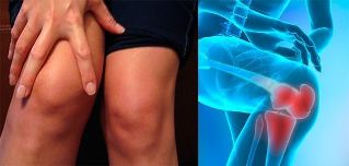 Η δυσφορία και το πρήξιμο στην περιοχή του γόνατος είναι τα πρώτα συμπτώματα της αρθροπάθειας